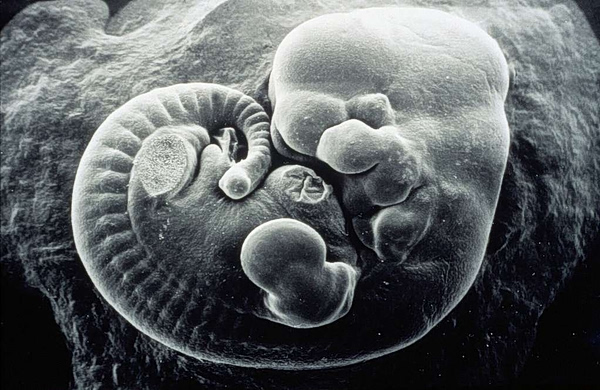 Ένα γράμμα του DNA αρκεί για να μετατρέψει θηλυκά έμβρυα σε αρσενικά