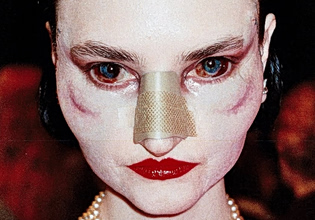 Παλιά, οι πλούσιοι δεν έμοιαζαν έτσι – Γκροτέσκα εξογκώματα, αφύσικα χείλη