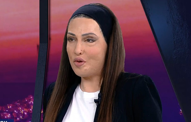 «Έξι χρόνια μετά, διαλέγω ακόμα τη ζωή»: Συγκινεί η Ιωάννα Παλιοσπύρου – Η ανάρτησή της