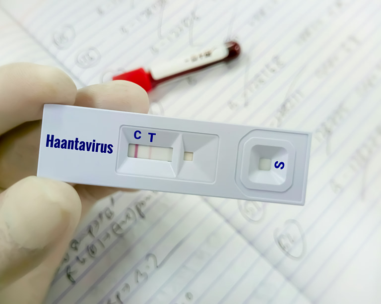 Ειδικός στο χανταϊό προειδοποιεί: «Άσχημο μικρόβιο – Μπορεί να προκαλέσει πολύ γρήγορη επιδείνωση και θάνατο»